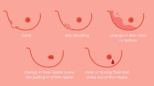 If your diagnosis is thyroid cancer, you may be able to breathe a bit easier, as it's one of the most treatable cancers when caugh. Breast Cancer Dimpling Tips For Identification