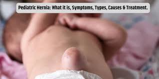Image result for Inguinal hernia child