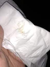 Tmi Bloody Show Or Meconium Af Or Post Cervical Check Discharge Babycenter