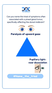 Image result for Pupillary Paralysis