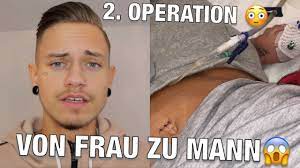 Von Frau Zu Mann Meine 2 Operation Youtube