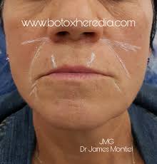 Smart Clinic Armonizador Facial