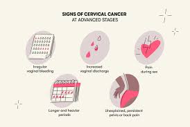 Image result for Cervical Cancer
