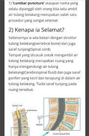 Terdapat 3 jenis kelainan pada tulang belakang diantaranya lordosis, kifosis, dan skoliosis adalah kelainan pada tulang belakang yang bengkok ke samping. Latif Saad En Twitter Pengambilan Air Tulang Belakang Tidak Menyebabkan Kelumpuhan Dia Lumpuh Sbb Penyakit Itu Sendiri Cth Meningitis Https T Co On5qbiuynk Https T Co Jii2wgx0nk