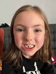 Yesterday was an historic event. Sage's first tooth loss. And the cutest  thing is that her school's office keeps special containers for taking your  tooth home and not losing it!