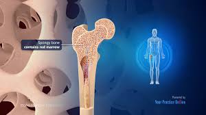 Image result for Bone Marrow Exam