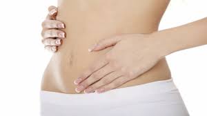 How much thinness achieved in the body with liposuction? Tummy Tuck Nuance Cosmetic Surgery Abdominoplasty