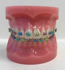 Orthodonture is so much more than straight teeth. people who try to make their own braces don't know enough about how the mouth functions to move. Services Michael J Wall Dmd Ms