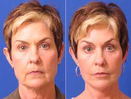 Check spelling or type a new query. Injectable Skincare Treatments Skin Savvy Advanced Aesthetics