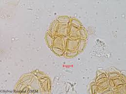 Image result for Allophylus lastoursvillensis