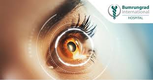 Double vision occurs when, because of failure of the eyes to move in parallel, the image of an object in the visual field does not fall upon the corresponding areas of the retina of both eyes. Double Vision Diplopia Treatment Bumrungrad Bangkok