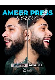 #amberpressmasterveneers #harmonydentalabs #barboursmiles  #elodontologodelasestrellas #porcelainveneers