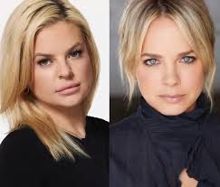 Did Maxie get her lips done too??