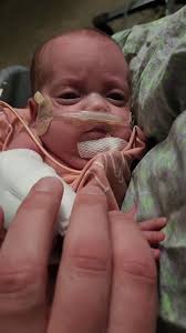 Baby Ivy Passed Away