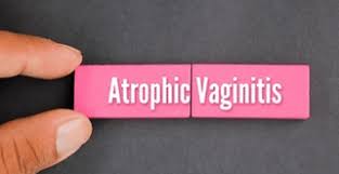 Image result for Atrophic Vaginitis
