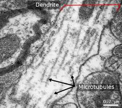Different kinds of animals have different lysosomes: The Cell 7 Cytosol Cytoskeleton Microtubules Atlas Of Plant And Animal Histology