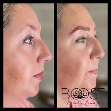 Heather Probst (@boost_esthetics) • Instagram photos and videos