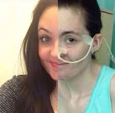 Today is World IBD Day, and where am I? I've been in hospital since Monday.  I've had bad issues with my joints, to a point I couldn't walk. I've been a  'Crohnie'