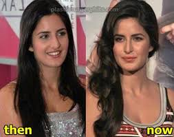 Katrina Kaif Plastic Surgery Before And After Nose And Lips Plastic Surgery Physical Beauty Beauty
