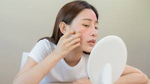 Confused About What Combination Skin Means? Let Us Clarify