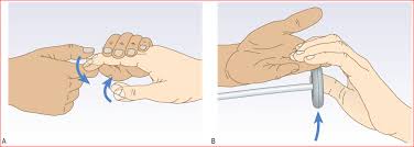 Image result for Supinator Reflex