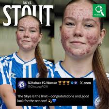 Su nombre es Skye Stout, una futbolista escocesa de 16 años, firmó  recientemente su primer contrato profesional con el Kilmarnock FC Sin  embargo, tras el anuncio del club en redes sociales, recibió
