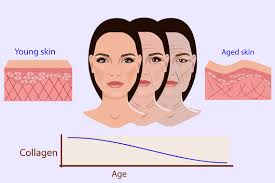 Kolagen (collagen) adalah jenis protein berserat dan tak larut yang jumlahnya paling berlimpah dalam tubuh manusia. Wajib Tahu Ini Manfaat Kolagen Untuk Kulit Pure Laser Clinic Indonesia