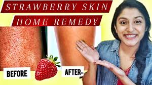 Having an ingrown hair means that a part of your hair, which typically grows out of the skin, gets either trapped in the skin and or is bent down and starts to grow in the wrong direction, which may then place the compress under your shoulder, press your arm against your chest and hold for 10 minutes. How To Get Rid Of Strawberry Legs Ingrown Hair On Arms Legs Youtube