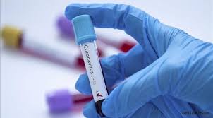 İşte bugünkü vaka sayısı tablosu son dakika: 17 Temmuz 2021 Turkiye Koronavirus Tablosu 38 Can Kaybi 7 Bin 666 Yeni Vaka Saglik Kayseri Canli Gaste