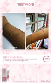 Cara menghilangkan lubang bekas jerawat bopeng dengan tomat. Cara Cepat Untuk Hilangkan Parut Chicken Pox Dunia Farisya