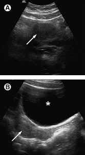 Check spelling or type a new query. Ultrasound Of The Pediatric Female Pelvis Sciencedirect
