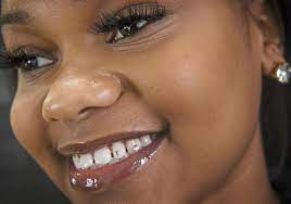 But how much does a diamond insert into a tooth cost? Tooth Gems Make Smiles Sparkle Pittsburgh Post Gazette