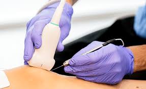 Image result for Radiofrequency Surgery