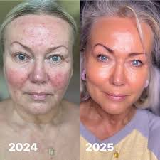 Finally, all cosmetics are done AUG