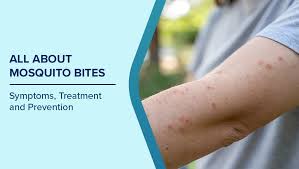 Image result for mosquito bite