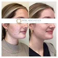 Crystal Sponamore BSN, RN (@crystal_injects) • Instagram photos and videos