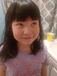 Two girls lost a tooth