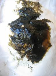 Image result for dark black stool human poop