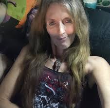 Prayer Request for Denise Dawson's Healing