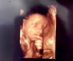 Erick Carrillo-Enriquez Obituary