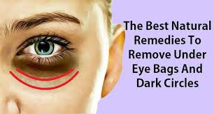 Are You Among The People Who Have Got Dark Circles And Bags Under Their Eyes Do You Feel Tired And Old Because Under Eye Bags Eye Bags Dark Circles Under Eyes