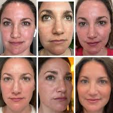 Cindy Rieger, Aesthetician- Professional, Licensed, Skincare