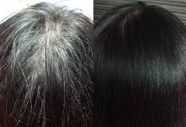 Springtomorrow Soins Capillaires Saci Beyazlardan Kurtararak Eski Rengine Donduren Tek Malzemelik Mucize Kur Hair Care Frizzy Hair Care Oil Blonde Hair Care