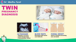 Image result for Multiple Gestation