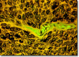 Sometimes that pain in your neck is more than an annoyance. Molecular Expressions Microscopy Primer Specialized Microscopy Techniques Fluorescence Digital Image Gallery Human Spinal Cord