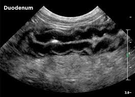 The presence of these tumors cause the dog's insulin levels to increase, in turn decreasing the glucose in their bloodstream. Small Animal Abdominal Ultrasonography Today S Veterinary Practice