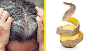 Sadece Patates Kullanarak Beyaz Saclardan Kurtulun Hair Loss Conditions Curly Hair Care Hair