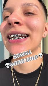 Bruce Gold Grills