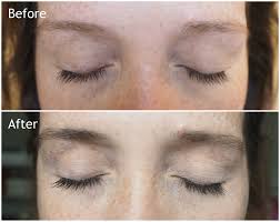 With over 6 million rapidlash® eyelash enhancing serum tubes sold and numerous awards won for rapidlash®, rapidbrow® and rapidrenew® we bring to you our growing line of rapidlash®. My Rapidlash And Rapidbrow Experience Before And After Melissa Jane Lee
