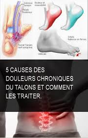 Pin On Astuce Sante